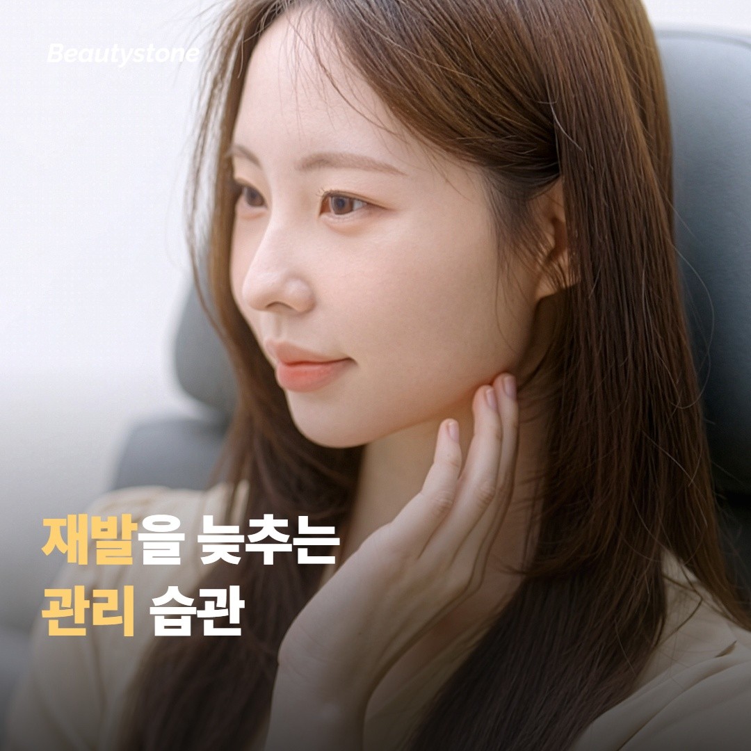 기미를 관리하며 재발을 늦추는 법이에요
