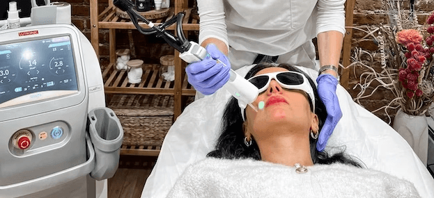 Upper Lip Laser Hair Removal NYC