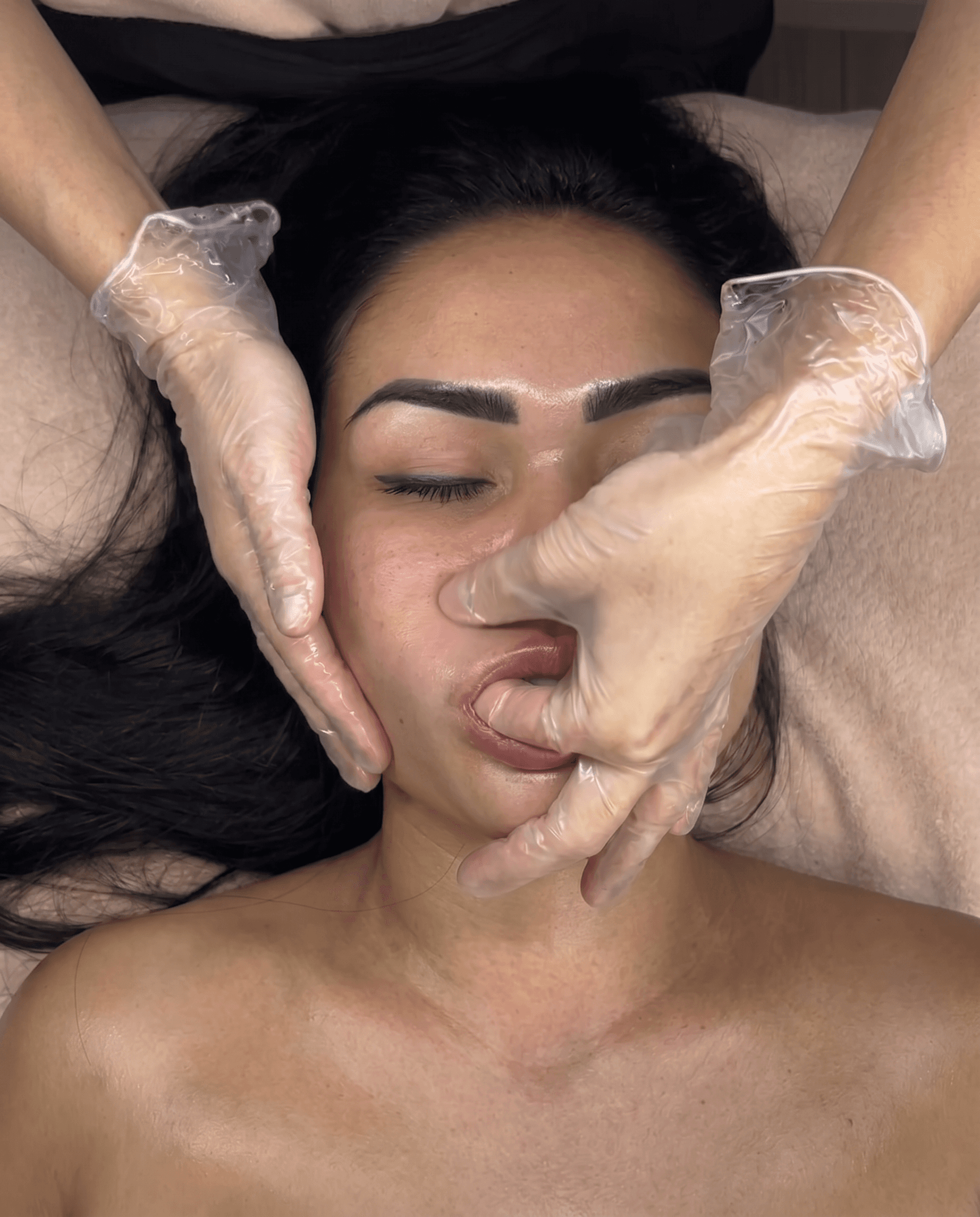 Treatment image