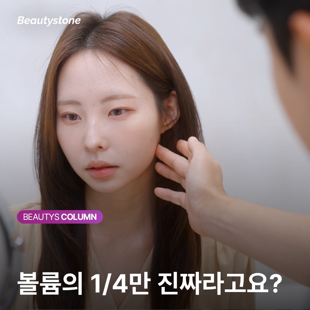 [คอลัมน์ วี ยองจิน] ผลลัพธ์ Juvelook: ทำไมใบหน้าที่ดูอิ่มฟูหลังทำทันทีถึงยุบแฟบลงภายใน 2 สัปดาห์