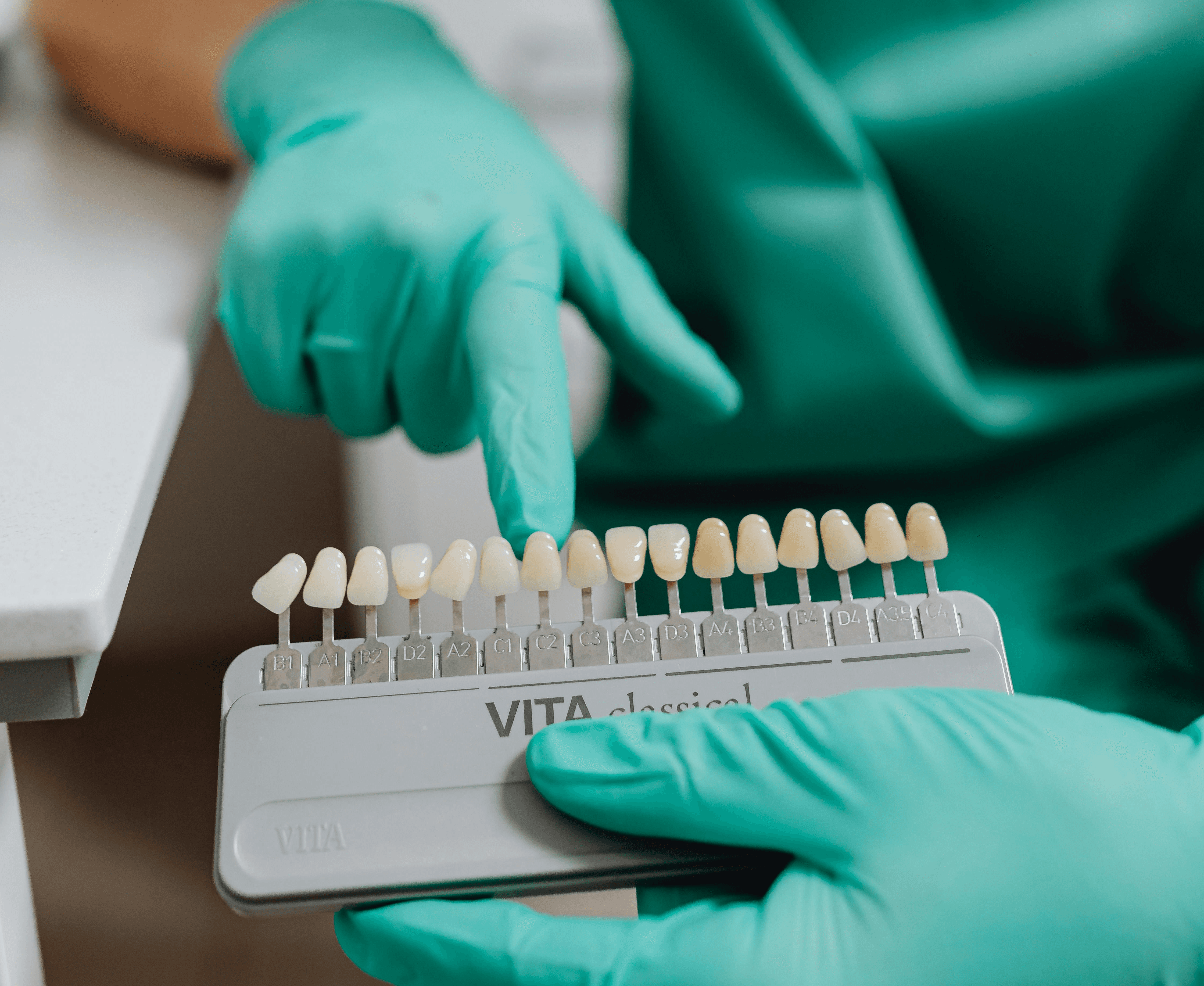 porcelain veneers