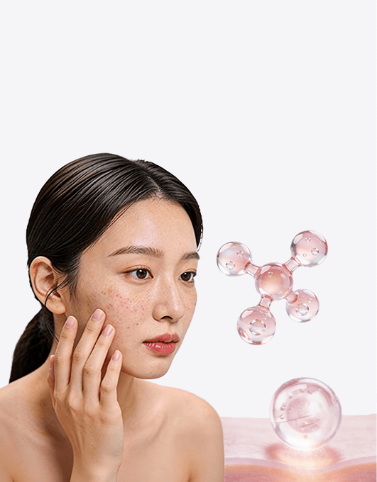 흉터는 파여있다면 세포를 수복해야 합니다 쥬베룩의 PDLLA | 홍대피부과 뷰티스톤의원