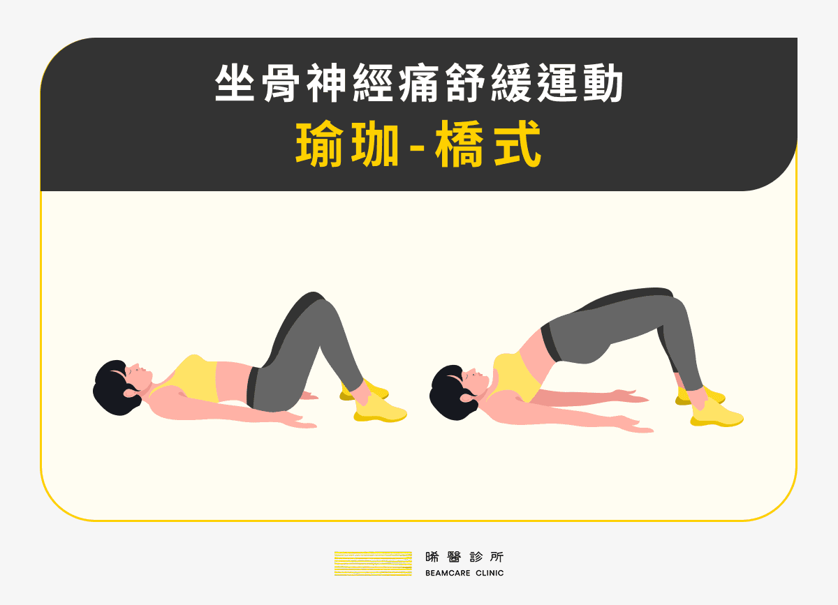 橋式運動示意圖