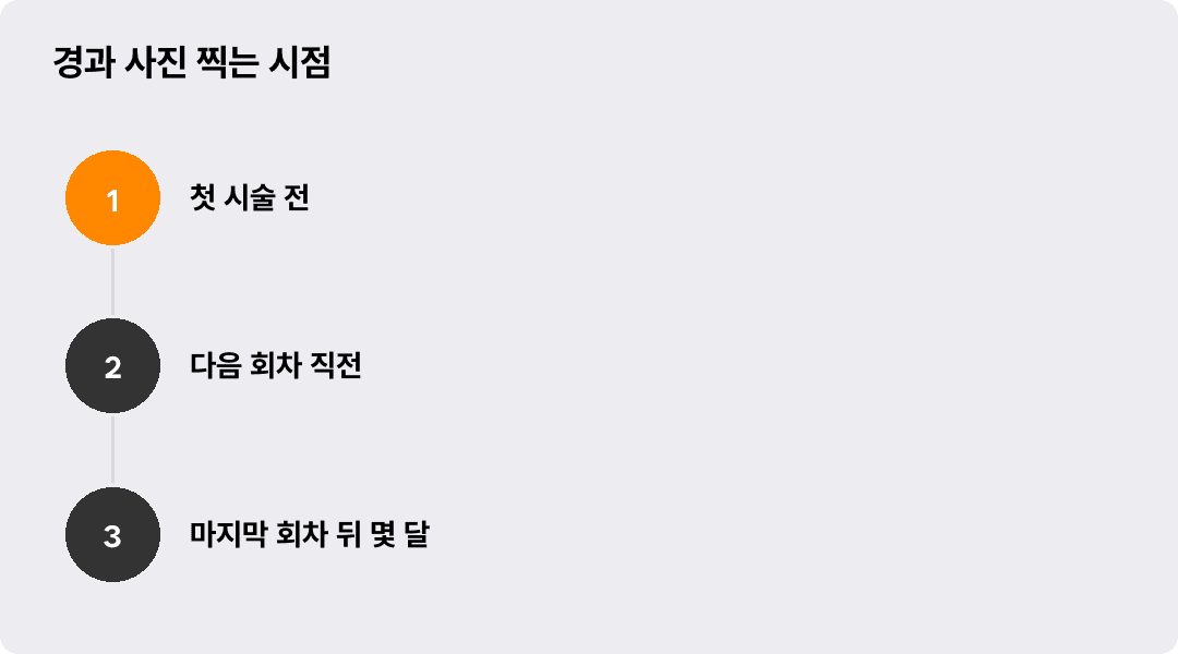경과 사진 찍는 시점