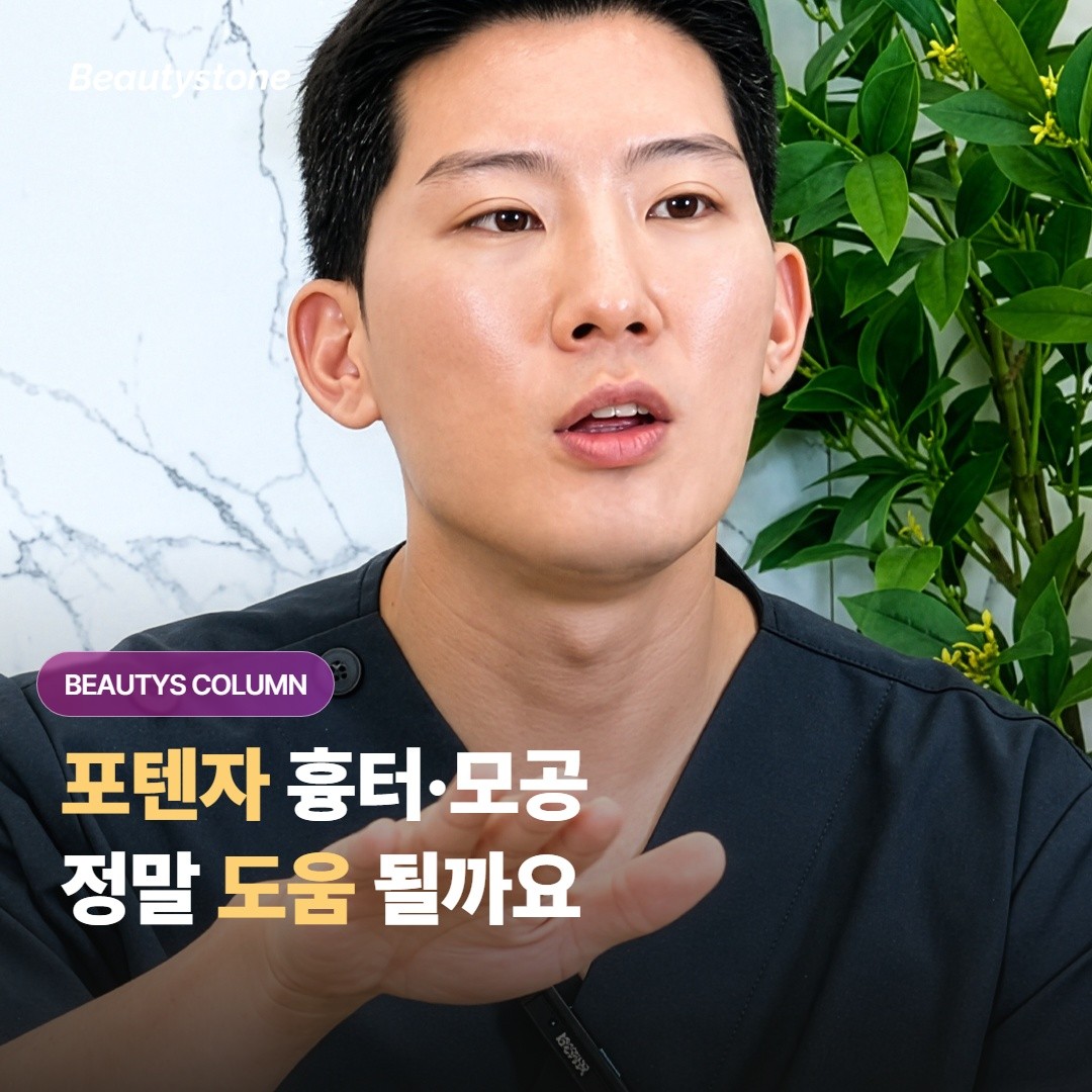 포텐자는 여드름 흉터랑 넓어진 모공을 줄이는 데에 정말 도움이 되는 시술이 맞을까요?