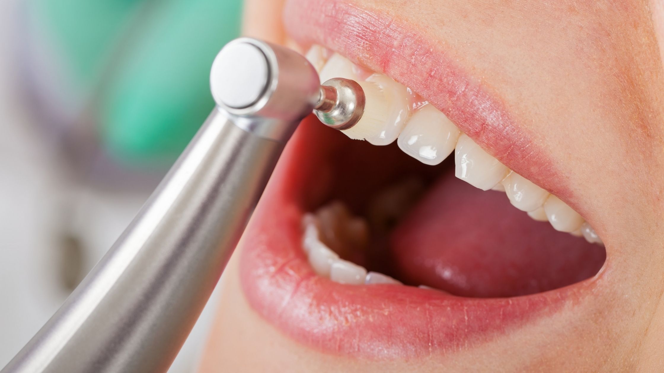 Dental Cleaning