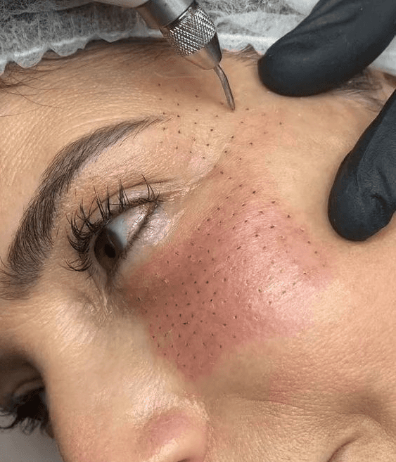 Work-Life Balance Couching