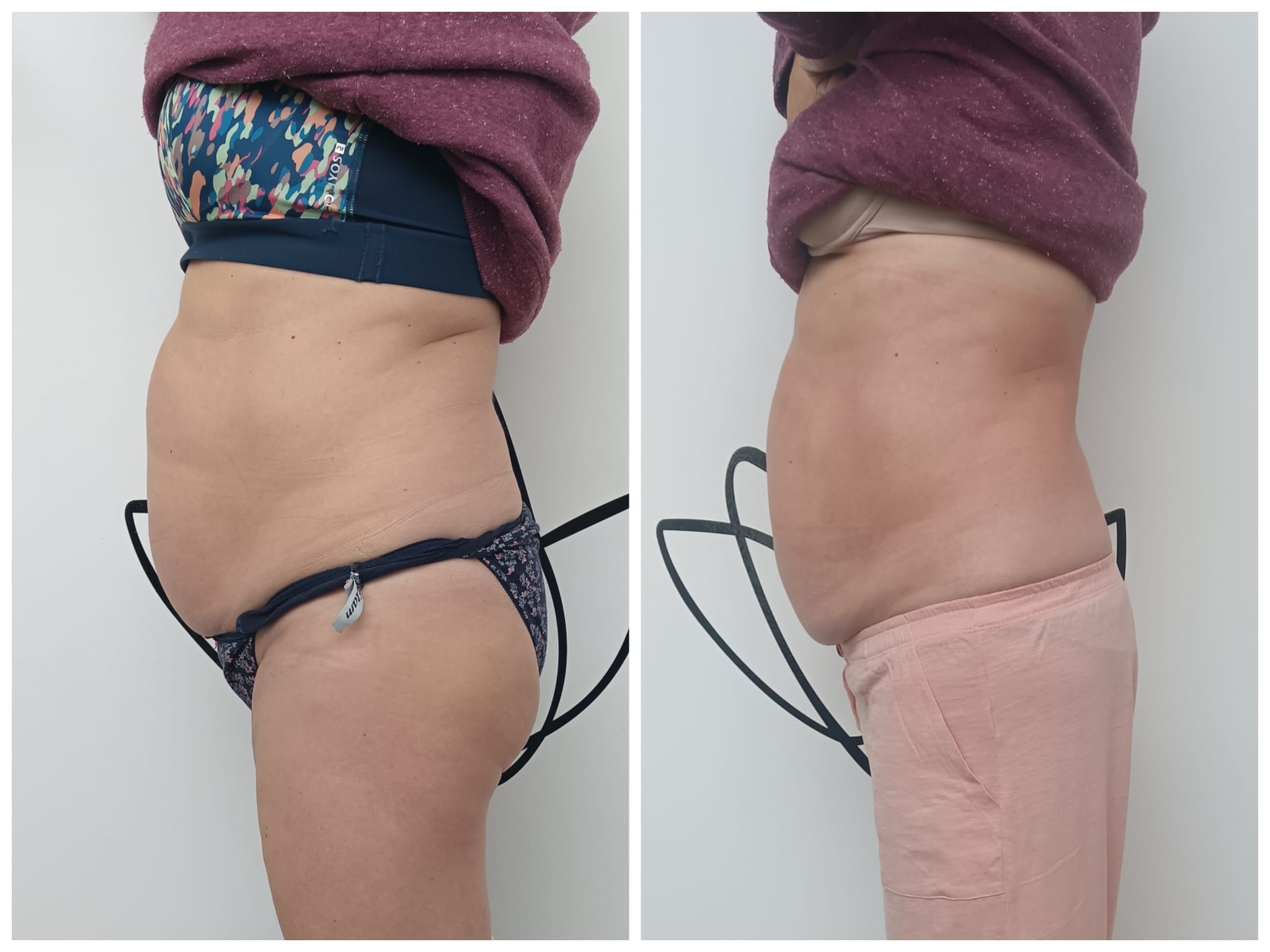 Transformation Photo