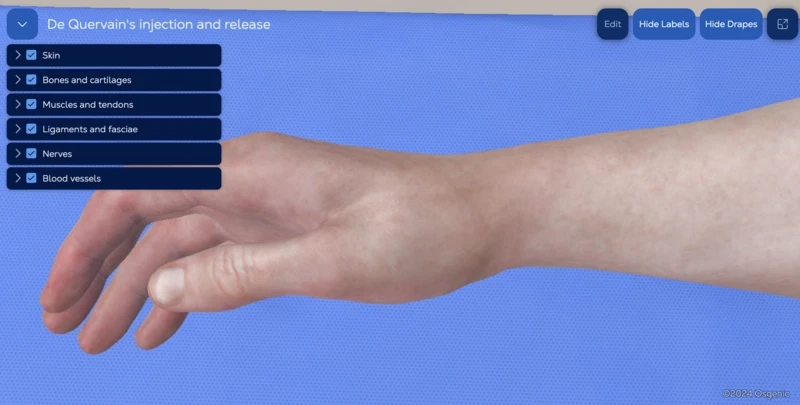 De Quervain’s release