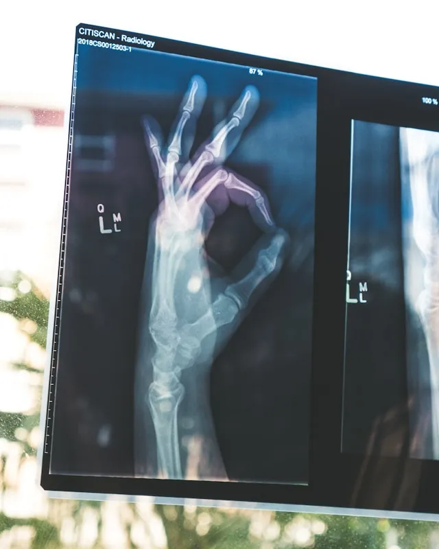 What you may get from K2 (over time) - hand x-ray