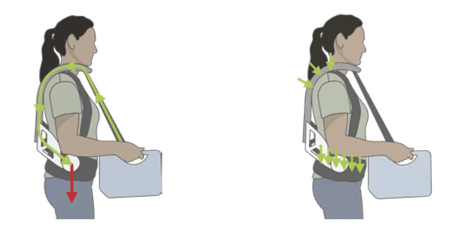 Illustration montrant le transfert des forces grâce à un exosquelette : à gauche, le poids est supporté par les bras et les épaules ; à droite, l’exosquelette redistribue la charge vers les hanches, réduisant la tension musculaire.