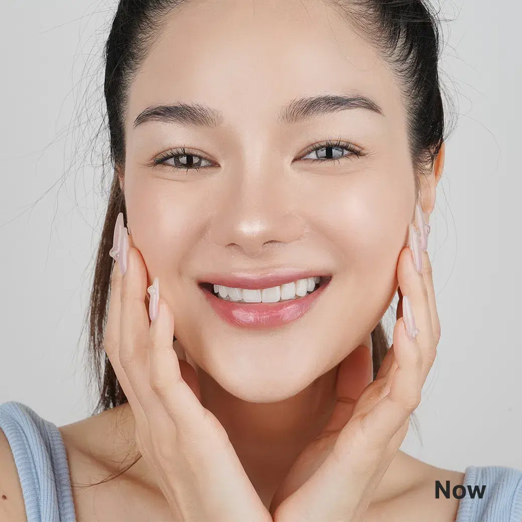 รีวิวออกแบบรอยยิ้มวีเนียร์ cosdent smile design