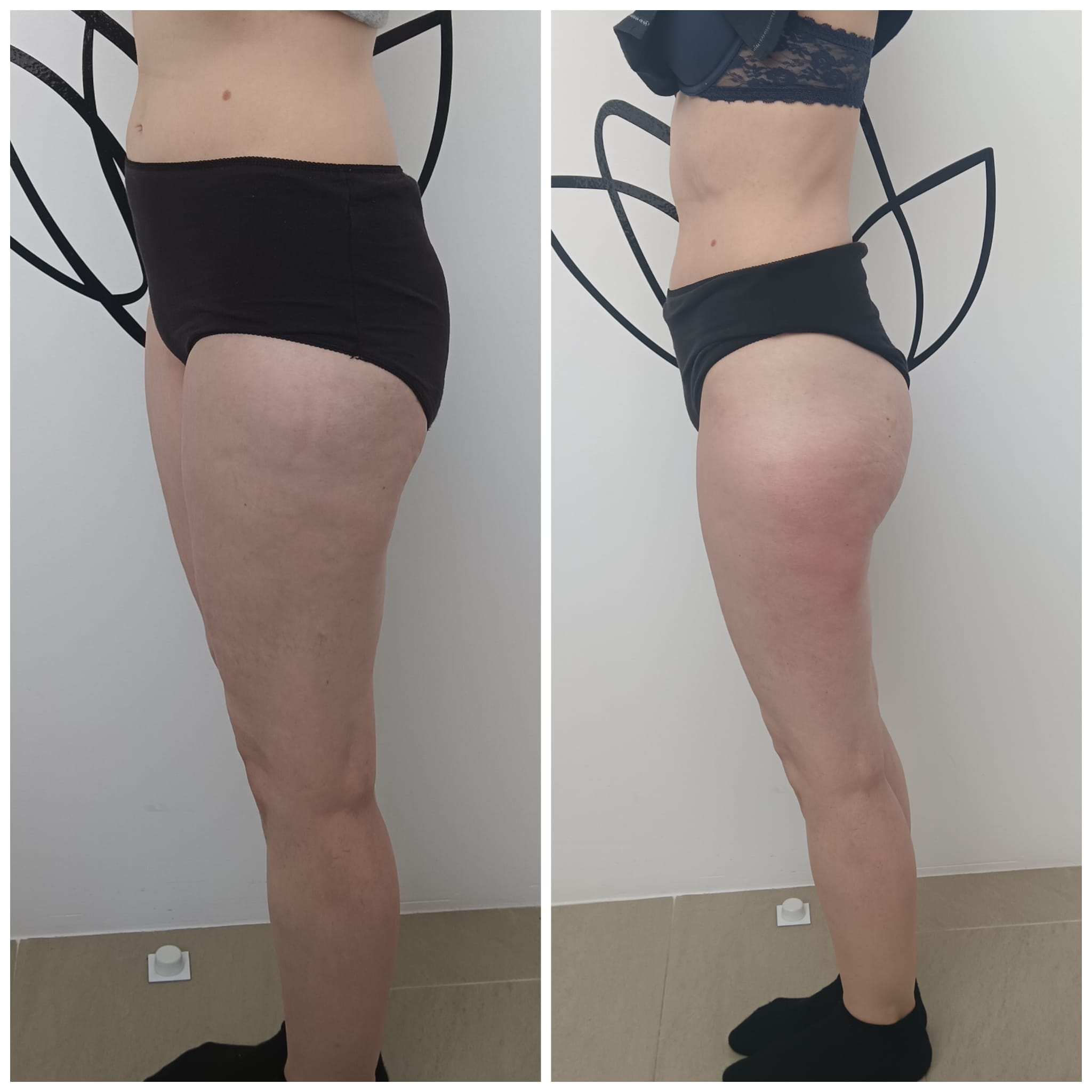 Transformation Photo