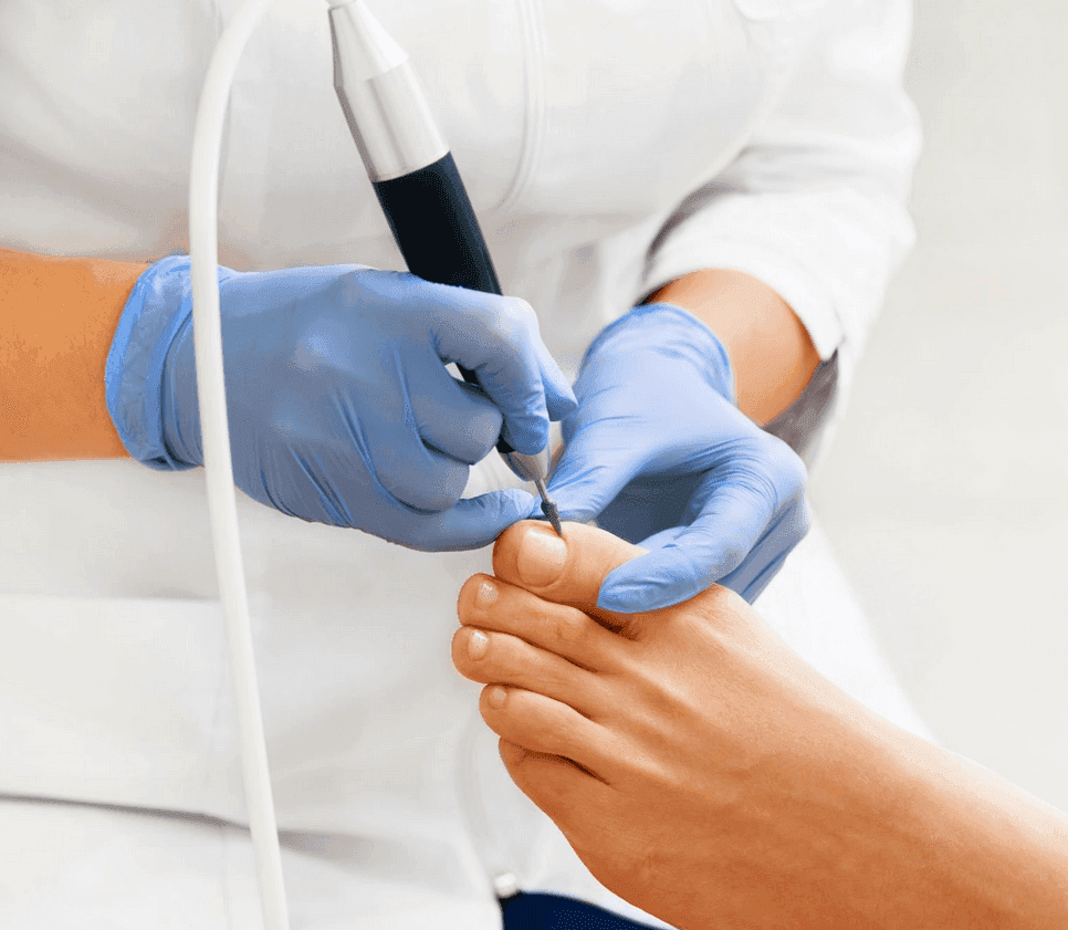 Piede studio podologia Potenza basilicata