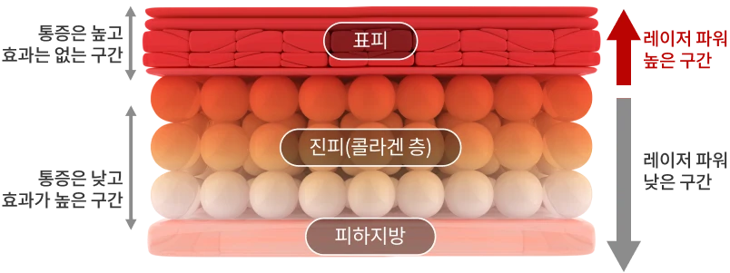 피부_올타이트_레이저비교_인포그래픽_르샤인-기존레이저