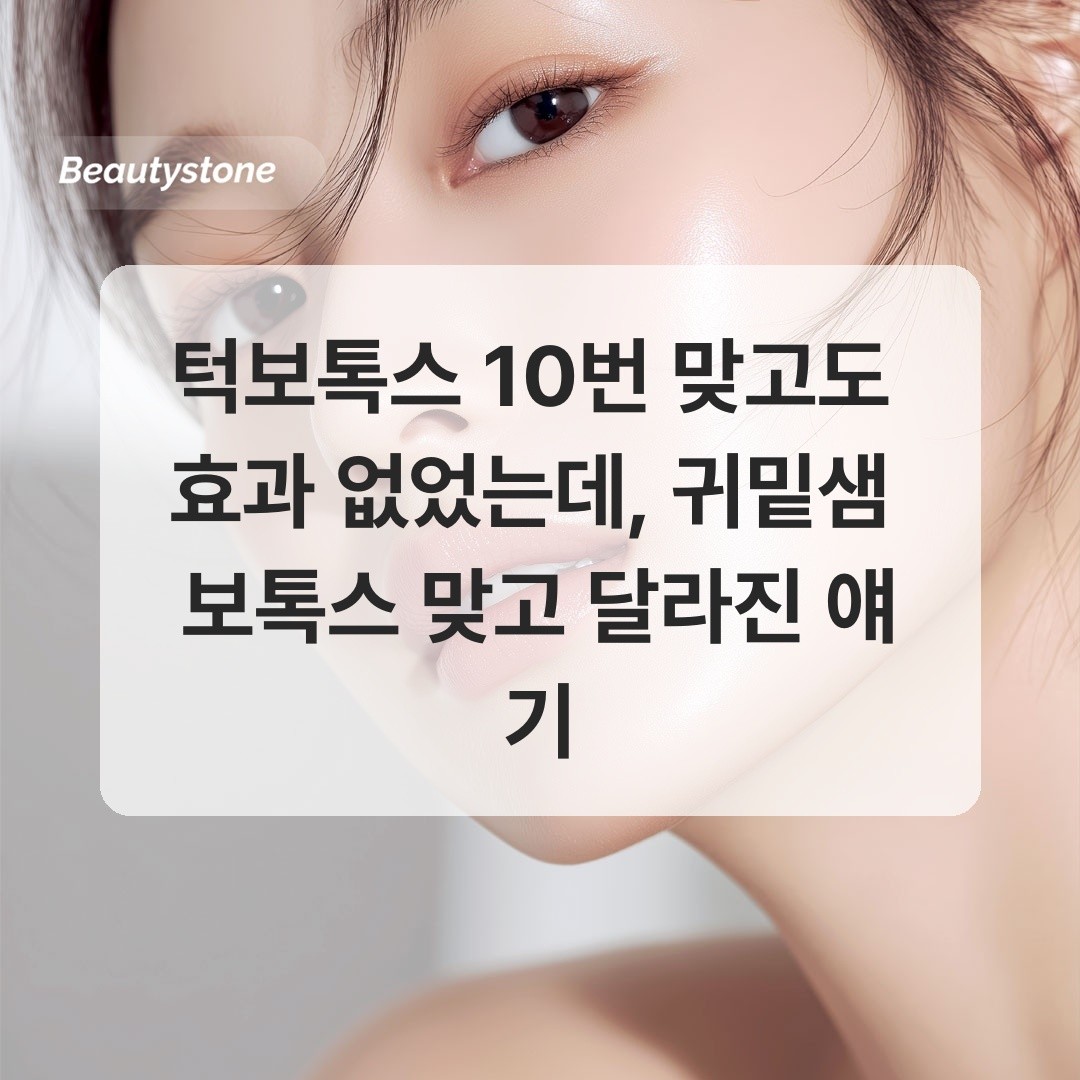 턱보톡스와 귀밑샘 보톡스 비교 시술 안내