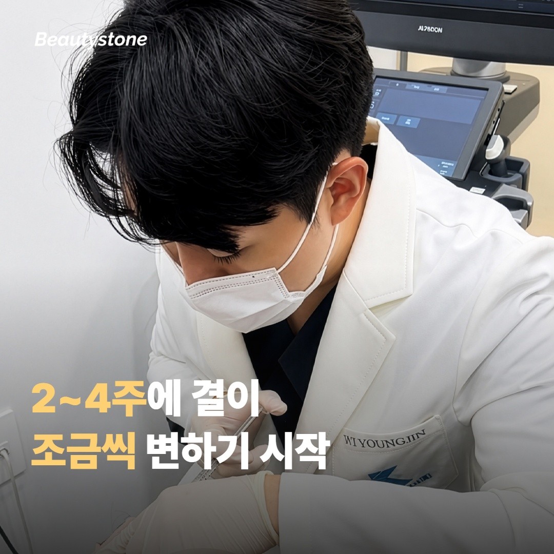 2주 ~ 4주 — 변화가 천천히 보이기 시작해요