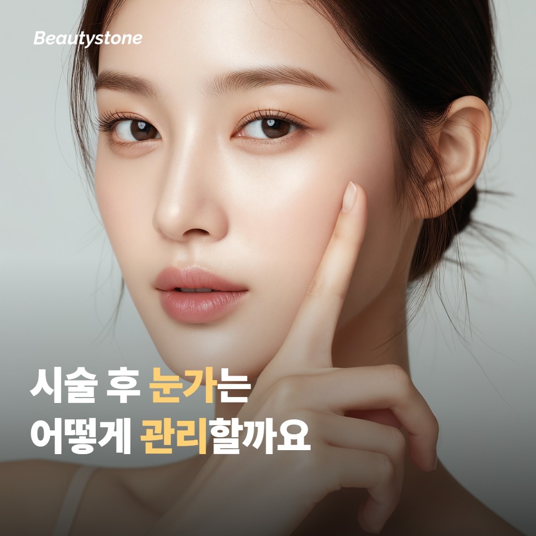 시술 후 눈가는 어떻게 관리하면 좋을까요