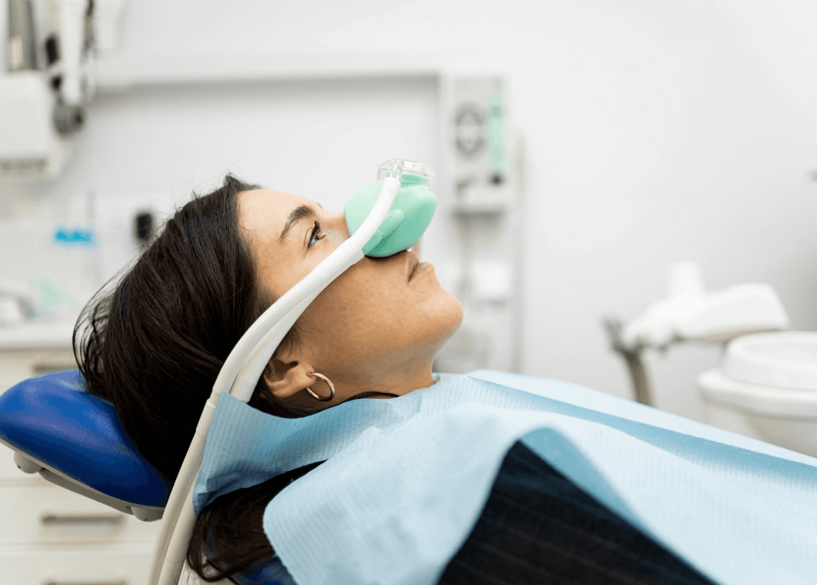 لقطة مقربة لوجه امرأة تُظهر ابتسامة هوليود سمايل بعد تركيب فينير الأسنان.