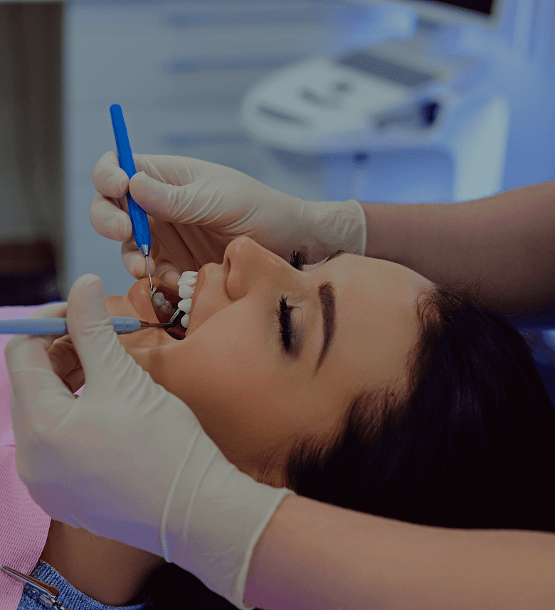 Teeth Whitening
