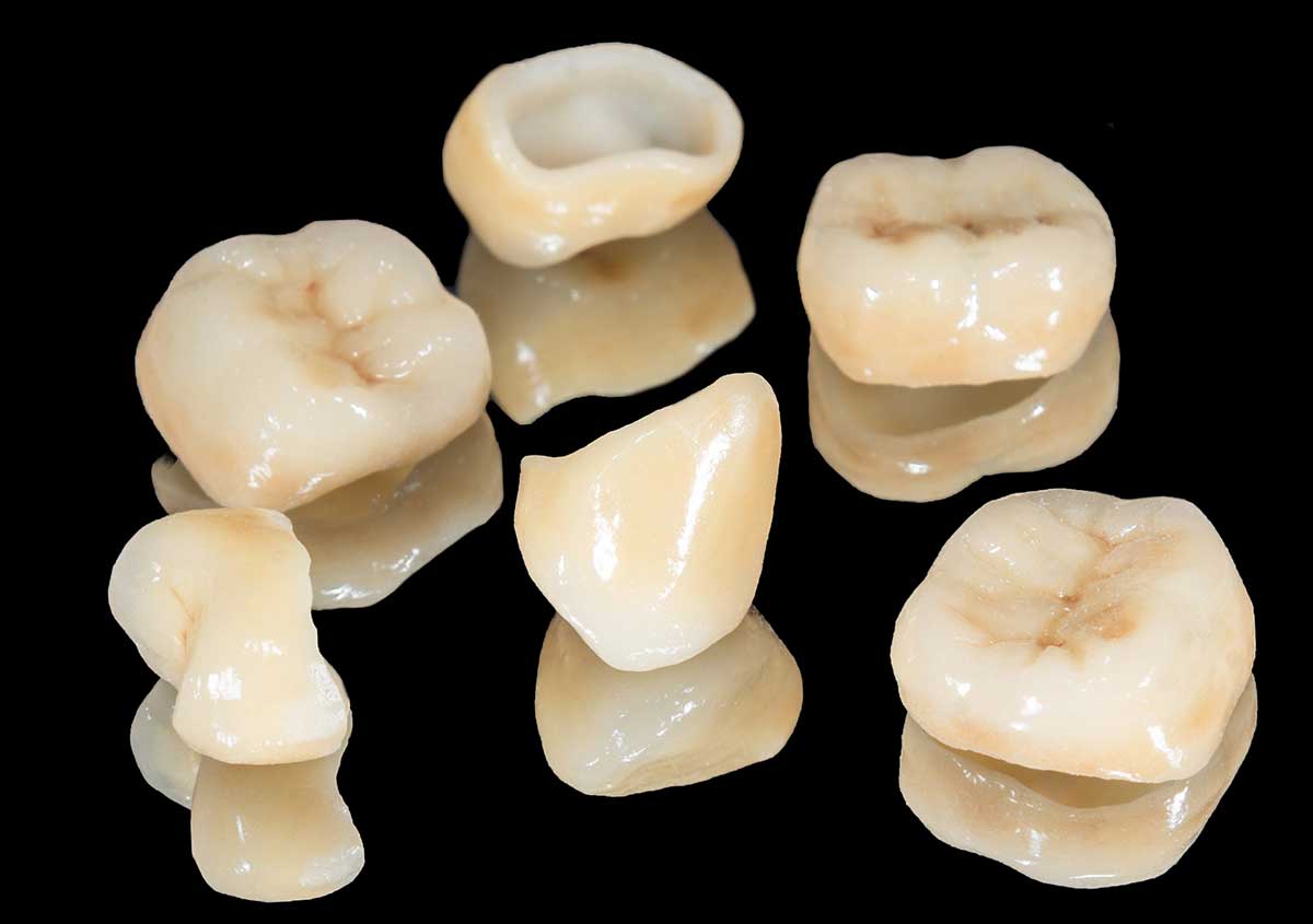 dental crowns in Mineola