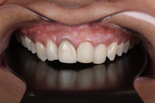 Dental professionals collaborating over a laptop in a clinical room.