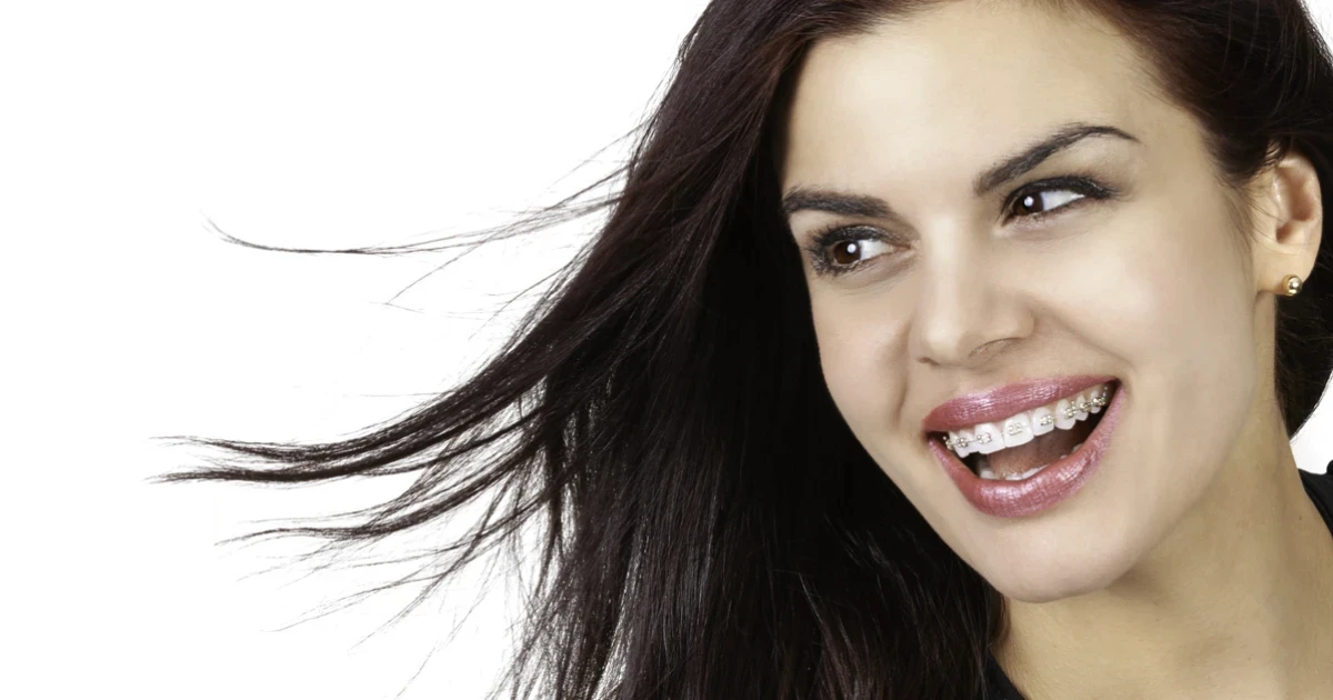 Kobieta z uśmiechem prezentująca efekty bondingu na swoich zębach.