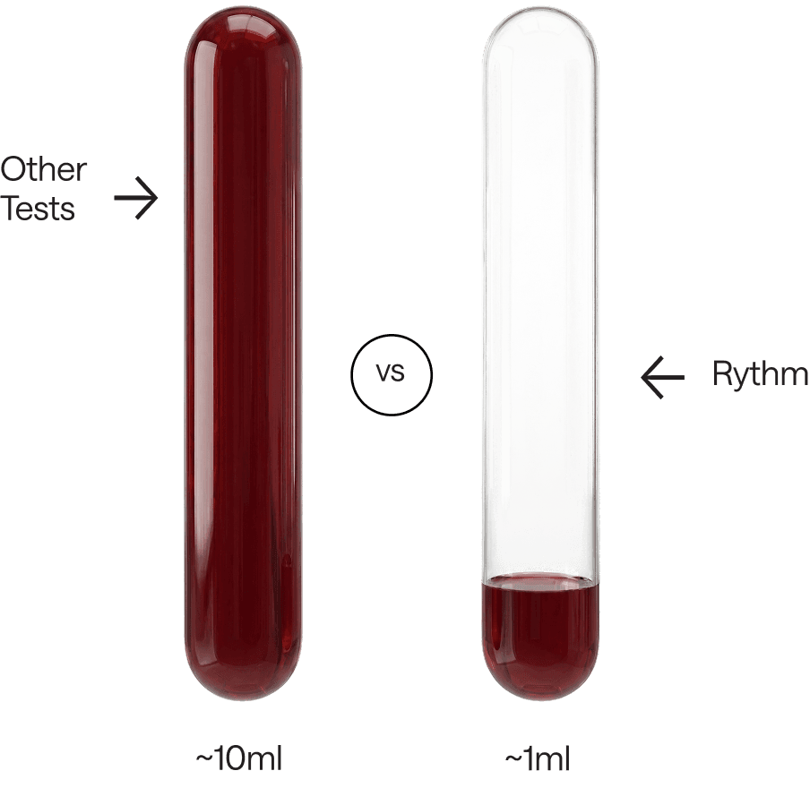 Comparison of two blood samples: a full test tube labeled “Other Tests” containing ~10 ml of blood, versus a smaller tube labeled “Rythm” containing ~1 ml of blood.