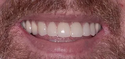 After Image