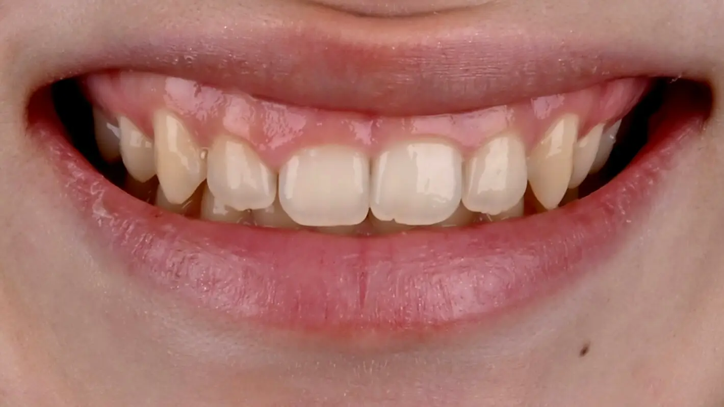 Foto mit Polarizationsfilter