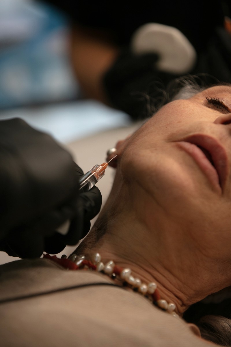 SkinPen® e Microneedling: la nuova frontiera per migliorare la qualità della pelle