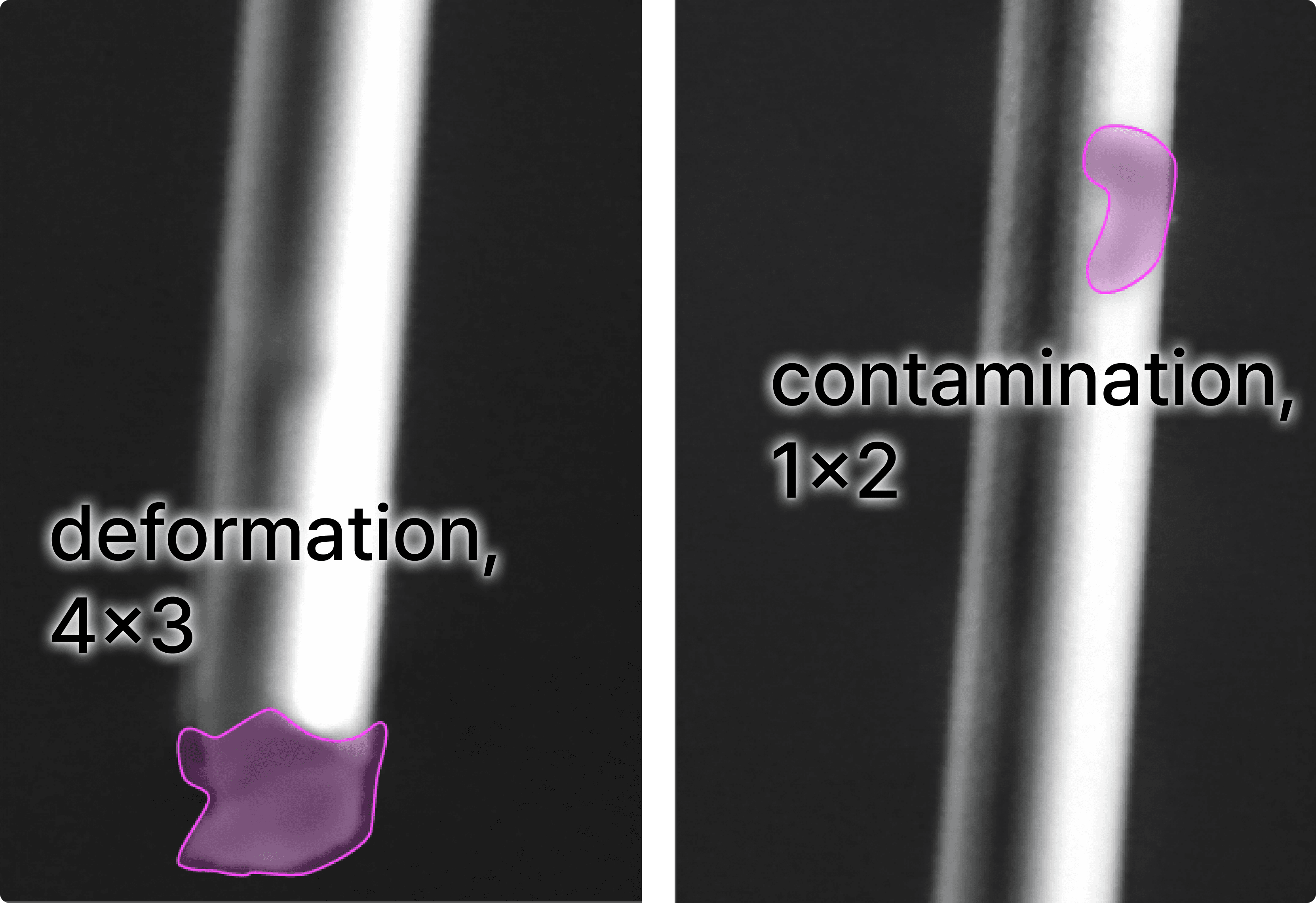 medical-device ai vision inspection