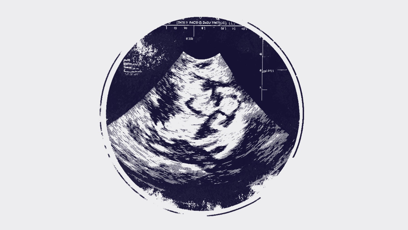 Ilustración de una ecografía en la carta al director Día del niño que está por nacer de IdeaPaís.