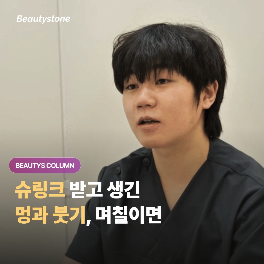 슈링크 시술 후 생긴 멍과 붓기, 며칠이면 가라앉고 회복기엔 무엇을 조심하면 좋을까요?