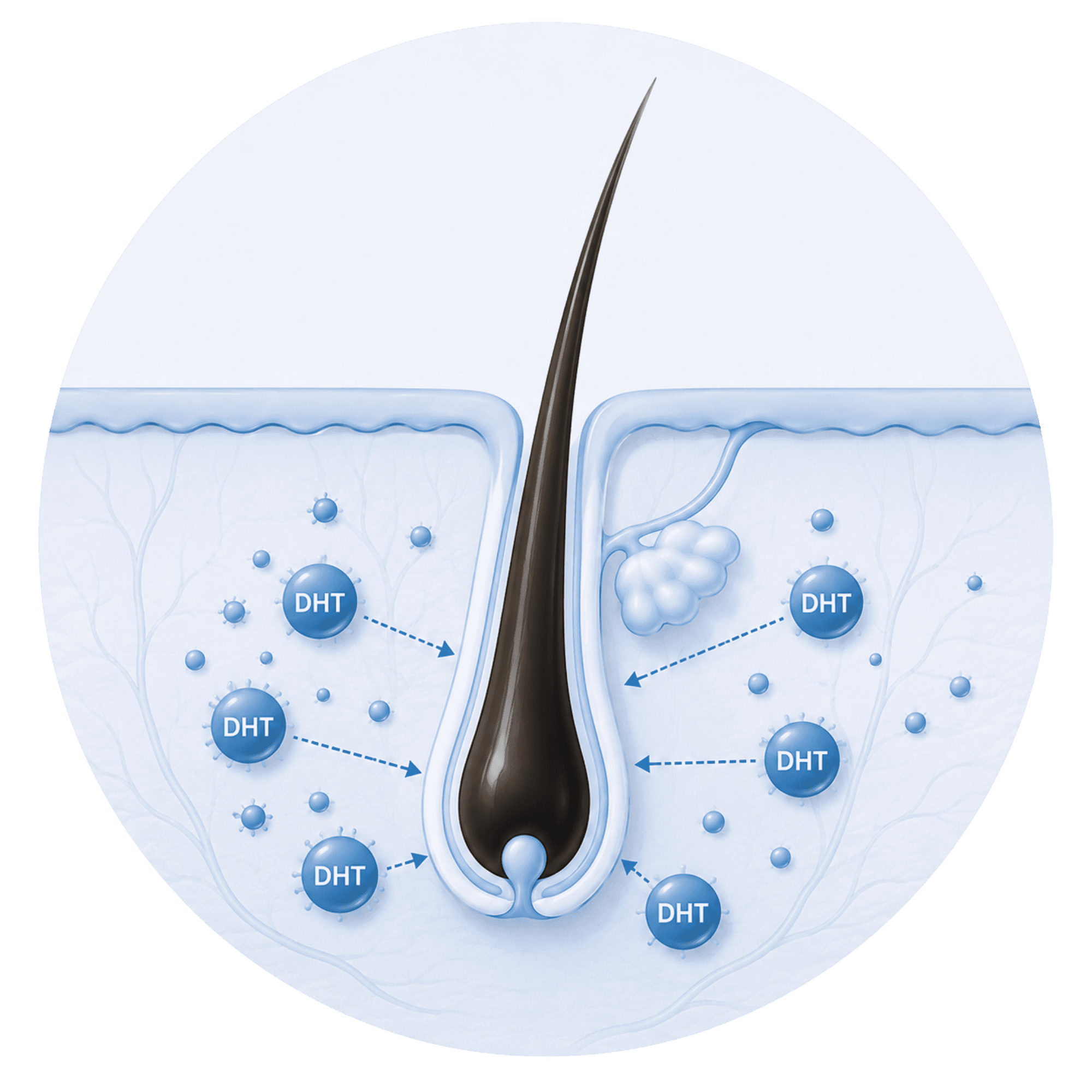 Illustratie van een gezonde haarfollikel omringd door DHT-moleculen, als uitleg van hoe gevoelige haarzakjes kunnen reageren op DHT.