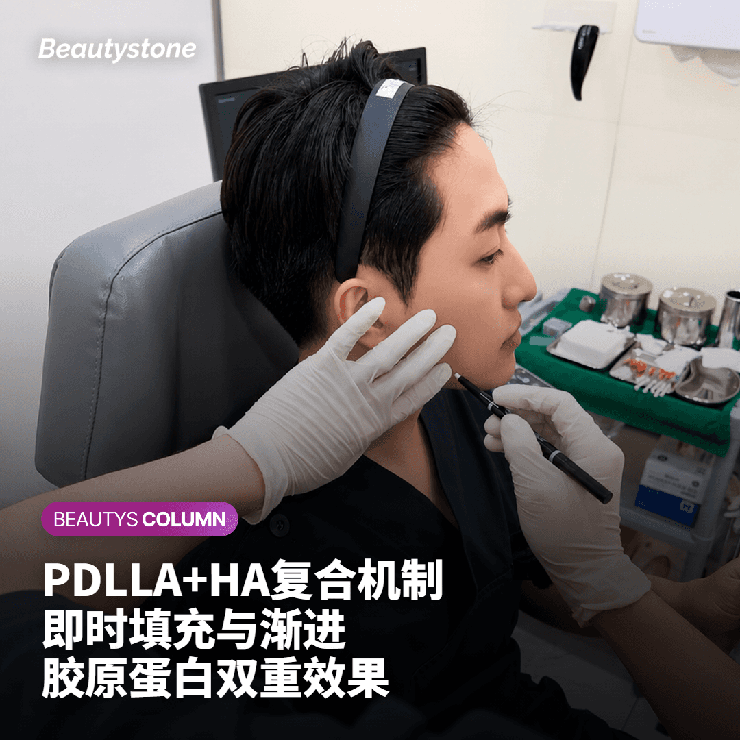 支数是怎么确定的?没有统一标准吗?