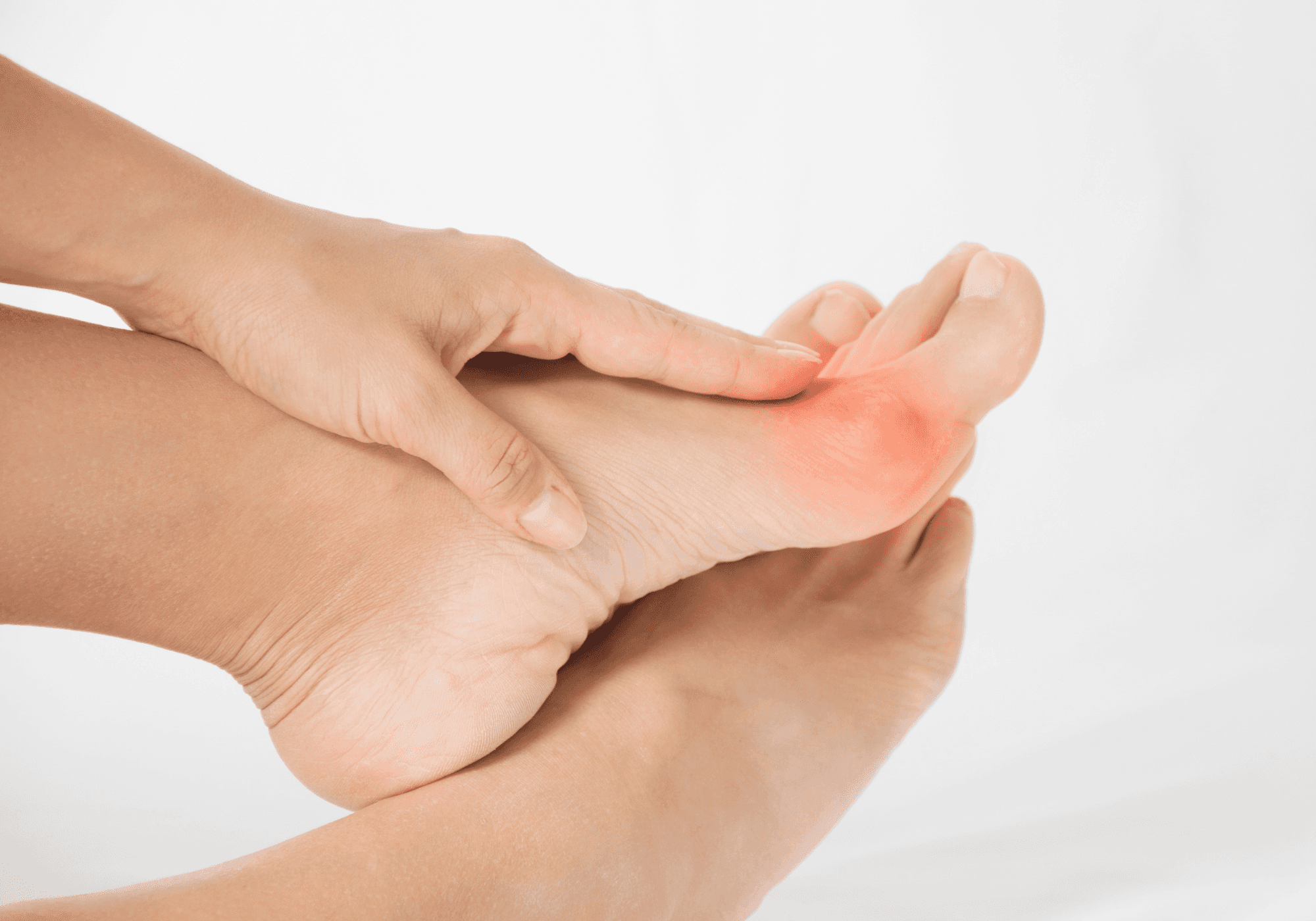 Corns and callus