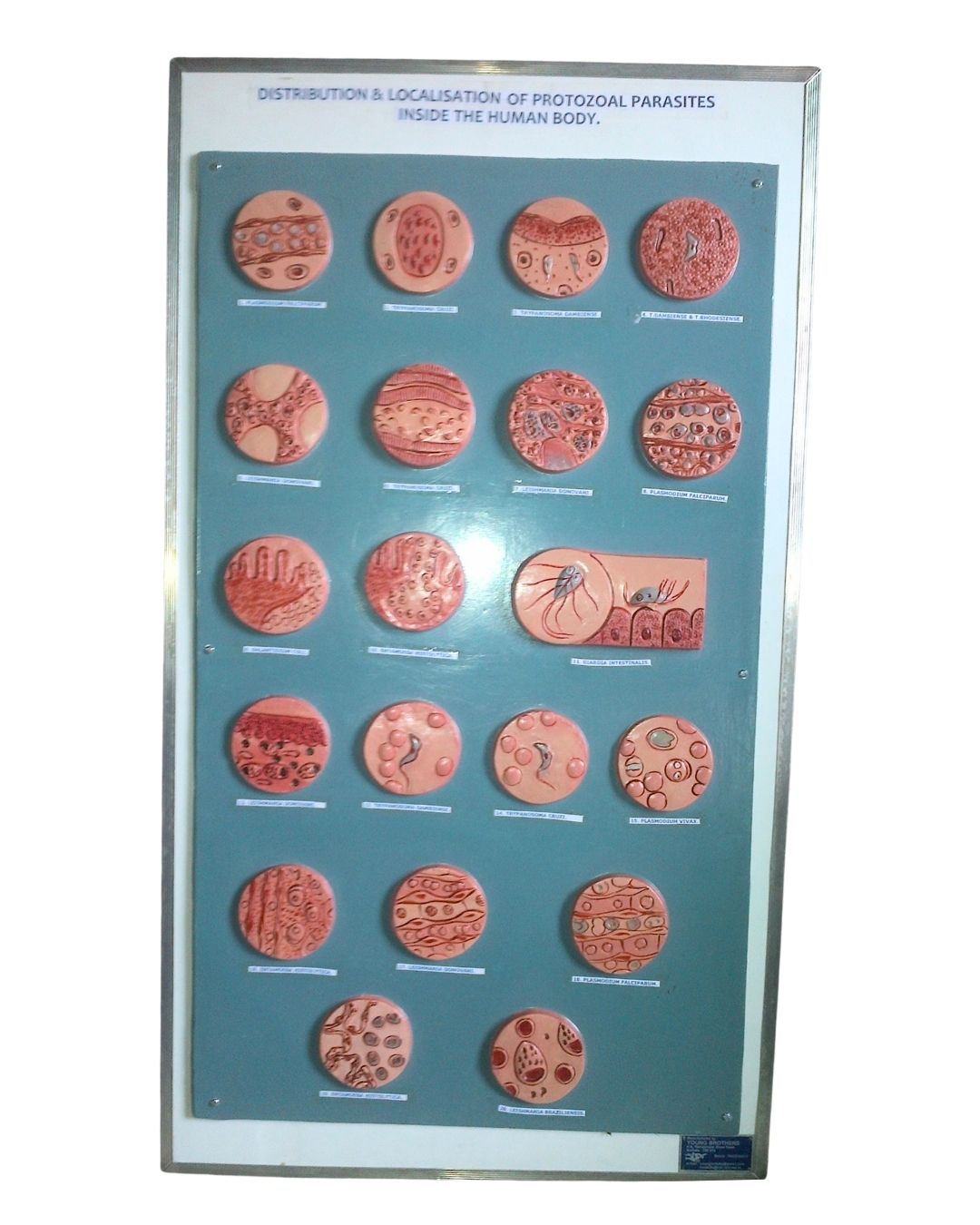 Distribution & Localisation Of Protozoal Parasites Inside The Human Body