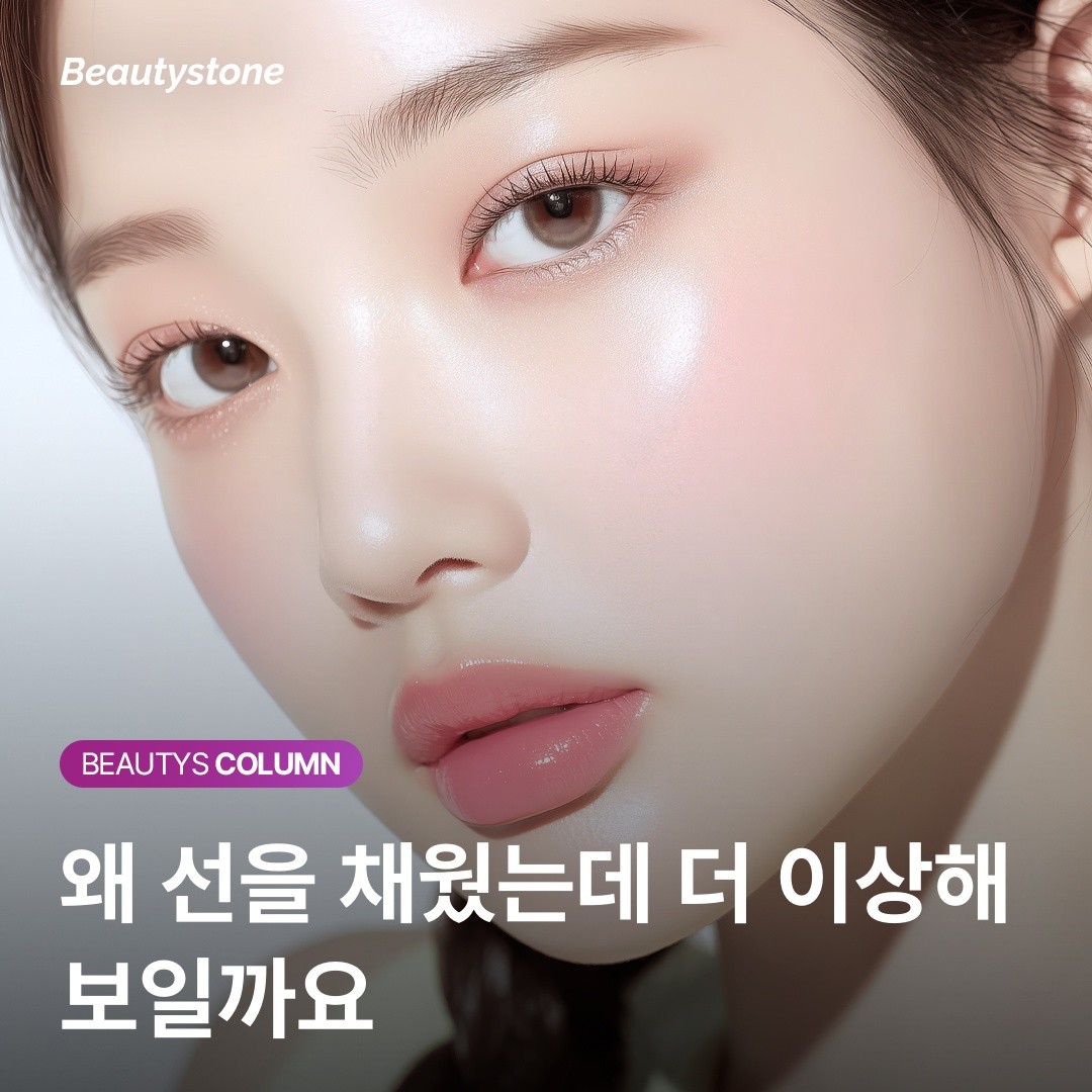 마리오네트 필러 후 입 옆이 불룩해졌다면? 꺼짐의 경계를 이해해야 합니다