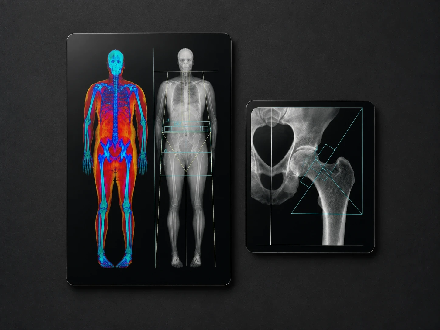stylised dexa scan output on a dark card