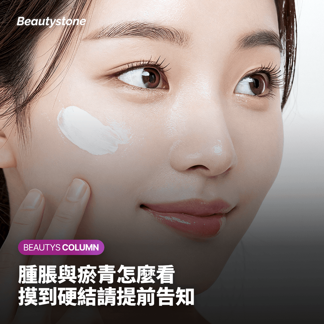 總結 Sculptra 注射後副作用與觀察要點的卡片