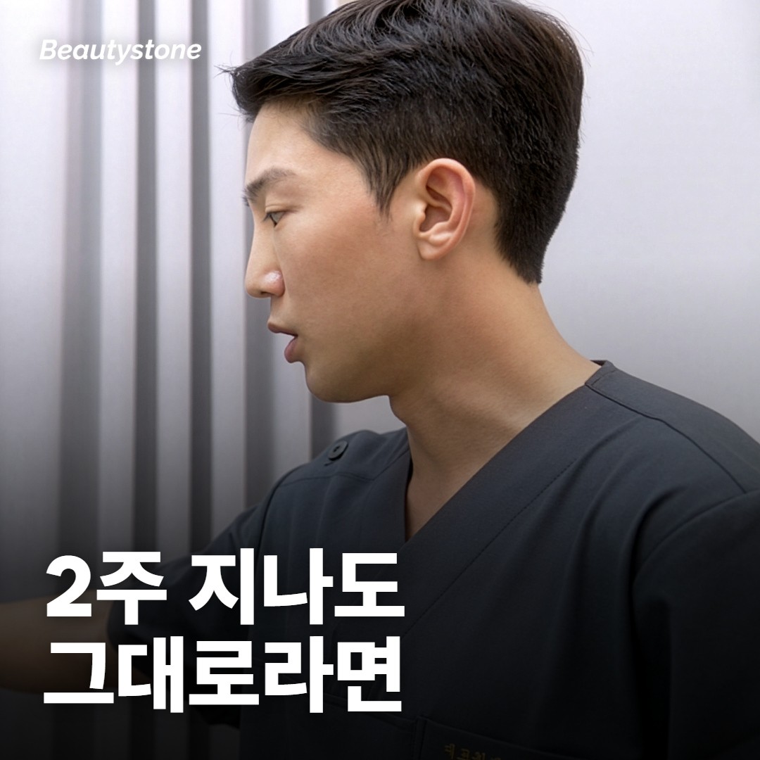2주가 지나도 그대로라면 확인할 것