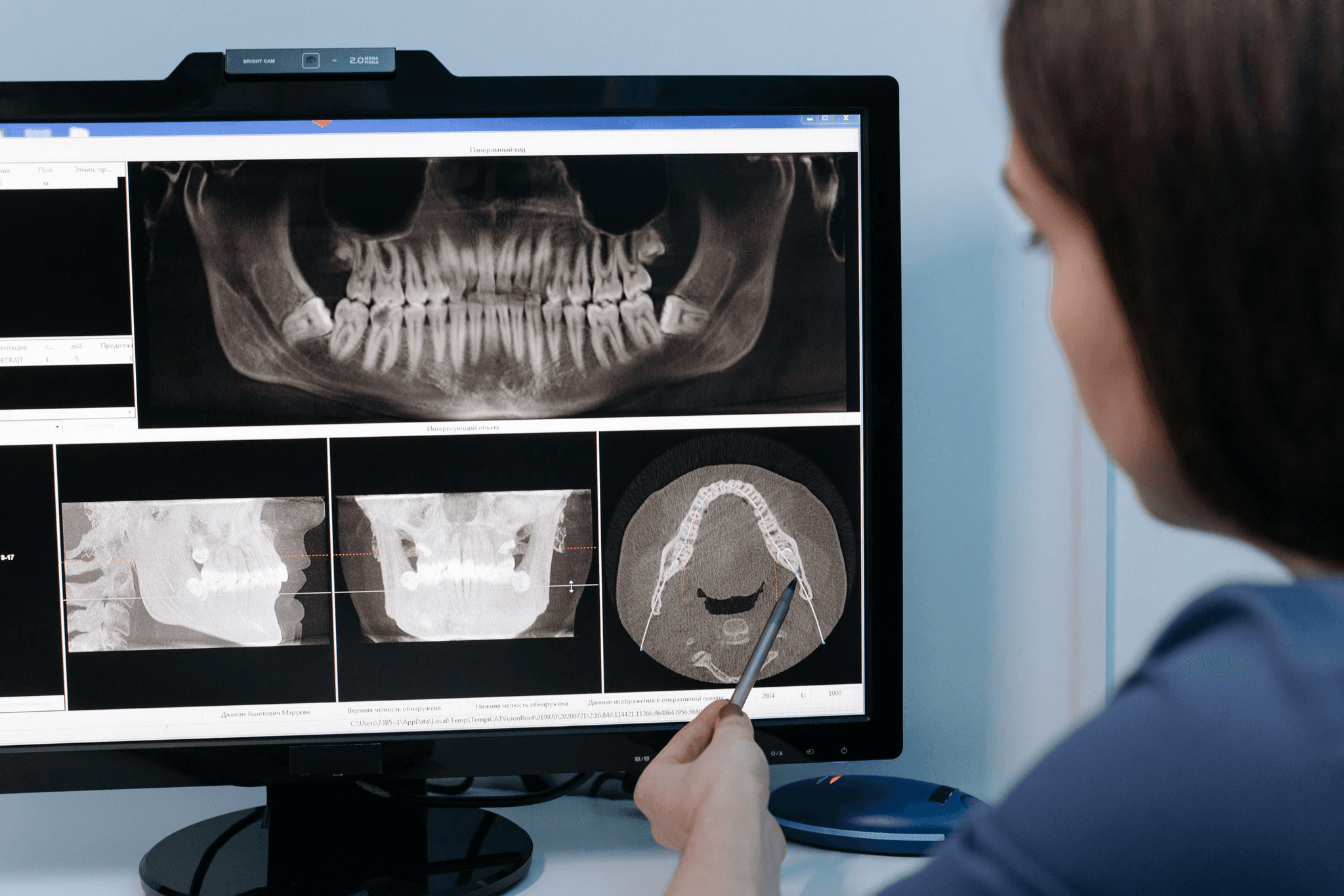 Dental treatments