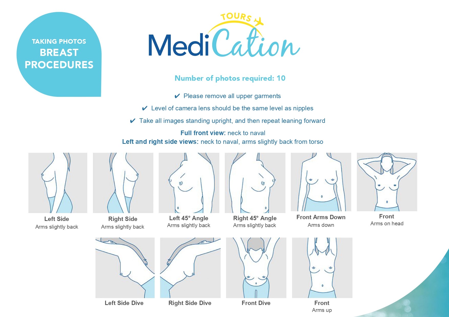 Breast surgery photo guide illustrating the required front, side, 45-degree, leaning forward, and arms-up positions for surgeon assessment.