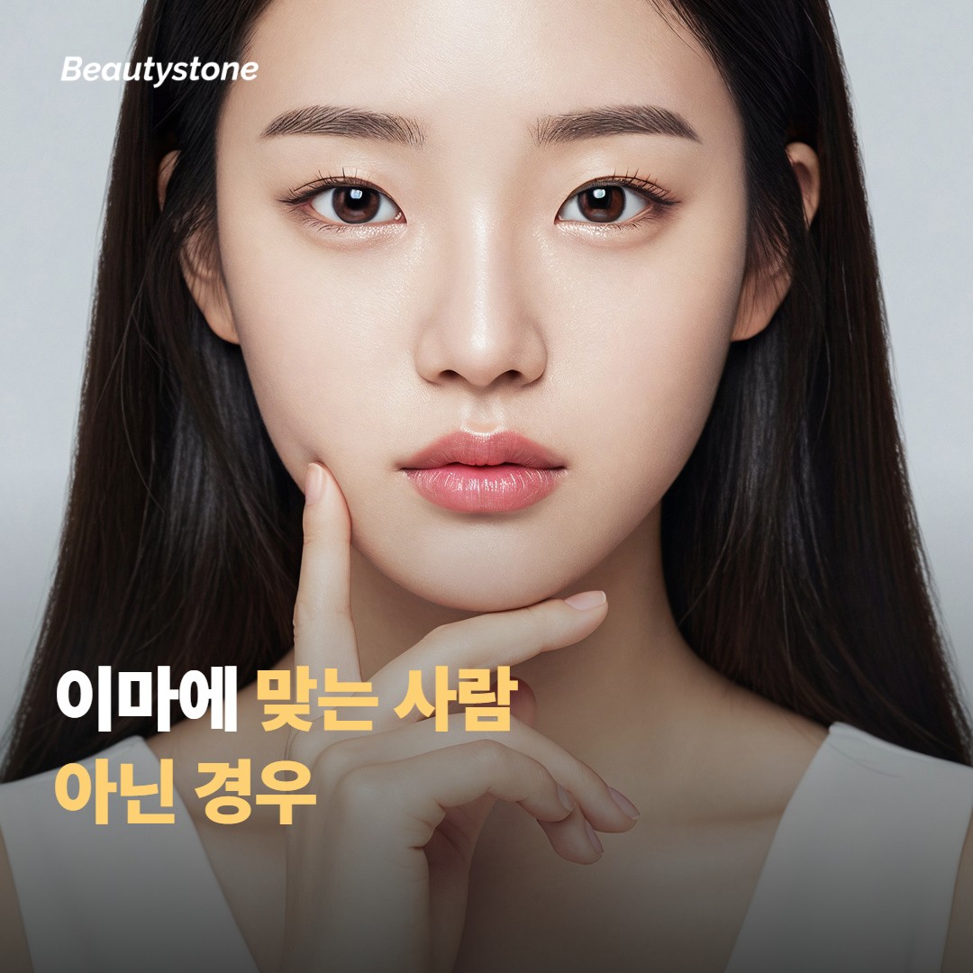 이마 볼륨에 맞는 사람과 아닌 경우