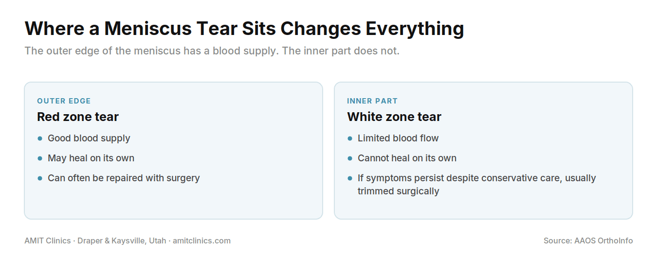 Comparison of meniscus tears in the outer red zone, which has blood supply and may heal or be repaired, and the inner white zone, which cannot heal on its own
