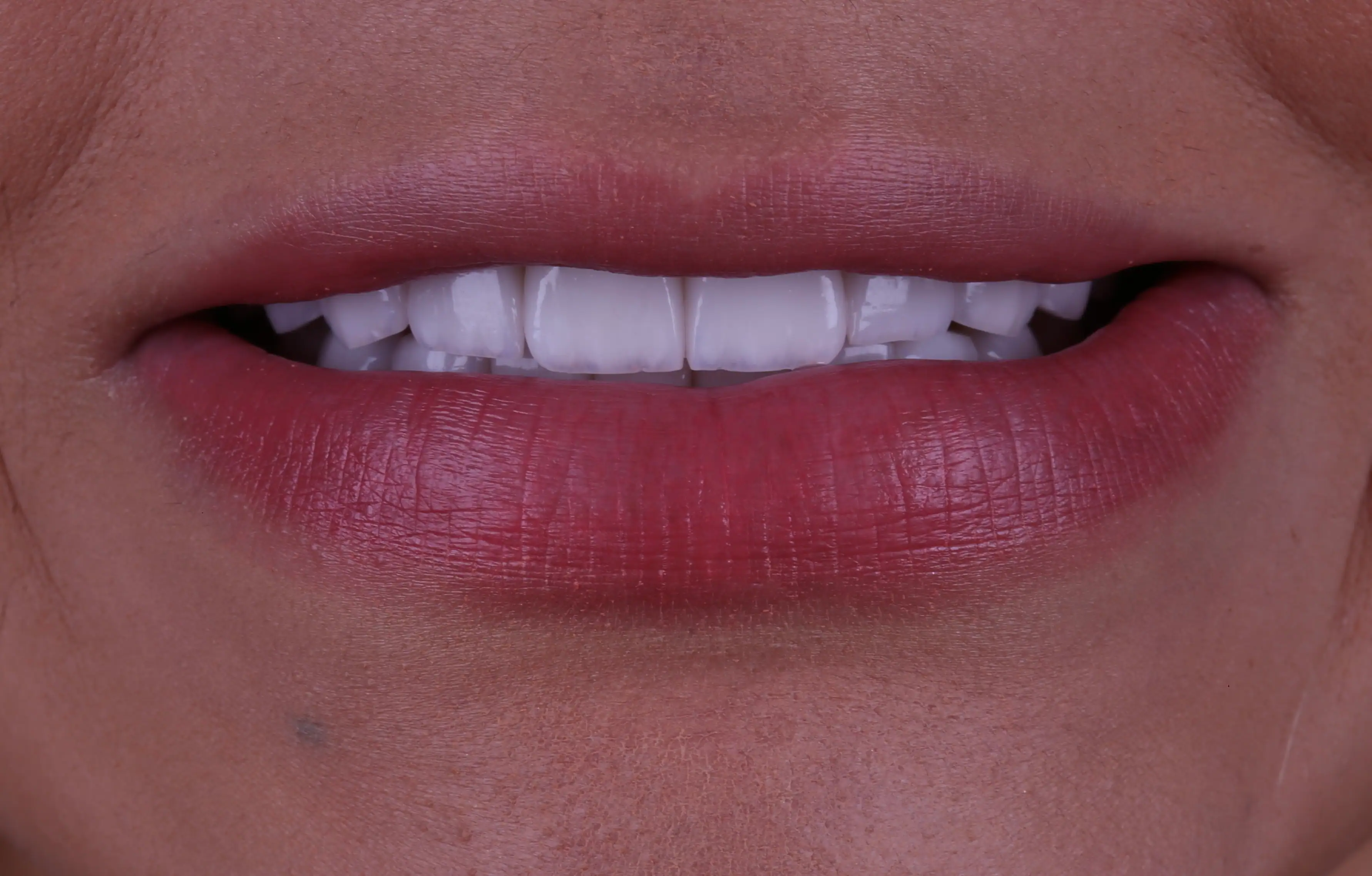 teste 2