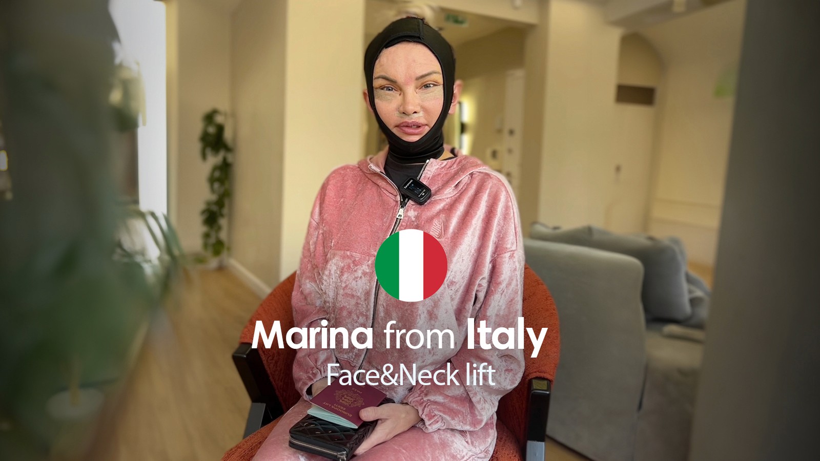 deep plane Face lift patient from Italy to turkey 