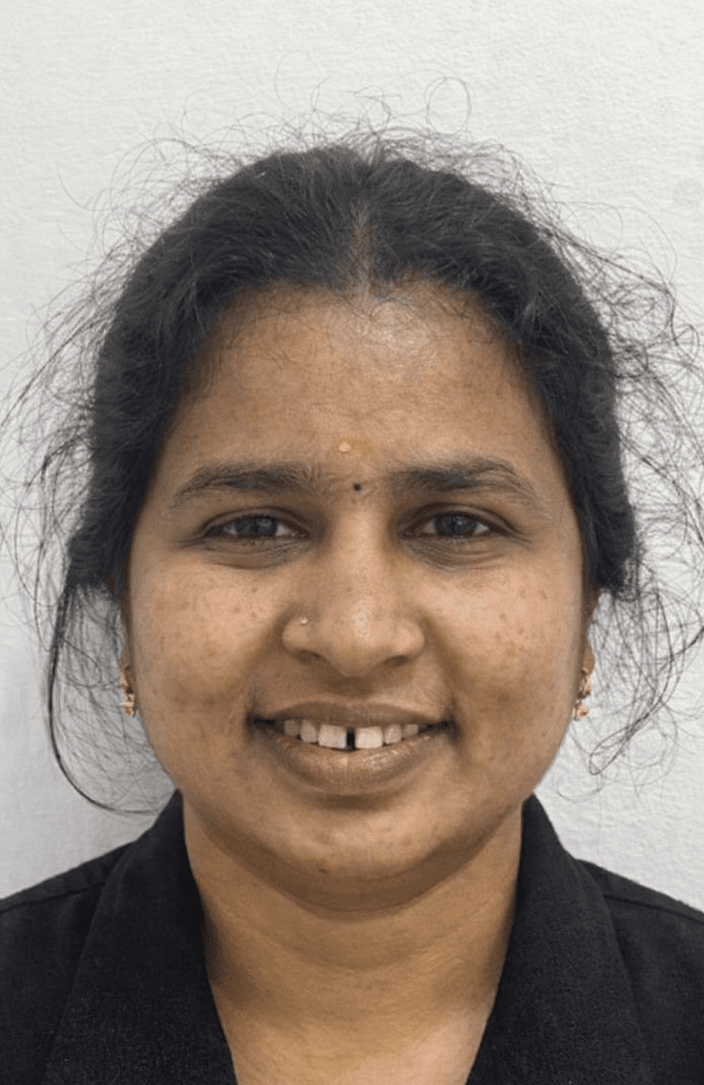 Close-up of smile showing yellowed teeth