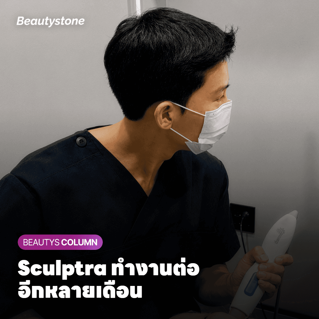 ภาพอธิบายอนุภาค PLLA ที่ค่อย ๆ สลายตัวและกระตุ้นการสร้างคอลลาเจน